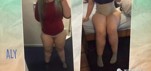 在亚城，这样的人比比皆是！这种影响着11%女性的病，简直绝望！