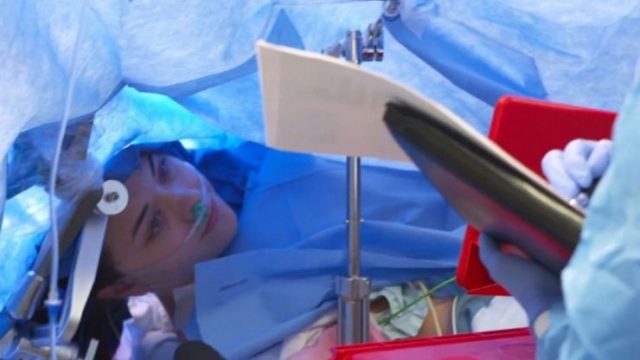 医院直播开颅手术 患者全程清醒