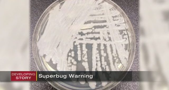 superbug