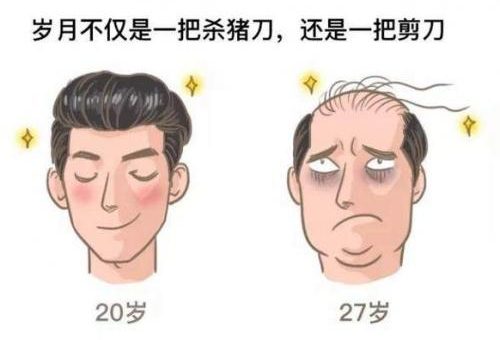 Image result for 男人二十帅不帅 脱发