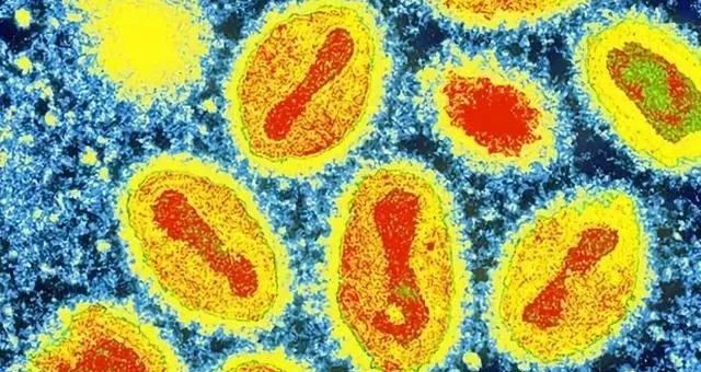 472人感染，70人死亡！一场新疫情正在非洲爆发！警钟已敲响，病毒的神秘，超出人类认知！