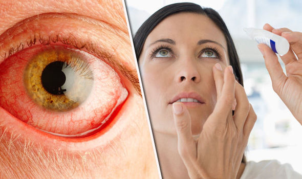 Image result for coronavirus red eyes